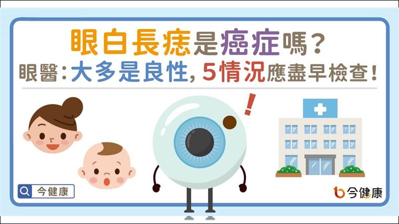 眼白長痣心慌慌　四類型是惡性！