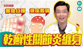 林科名醫師提醒，乾癬性關節炎是需要長期抗戰的慢性發炎疾病，患者應定期回診規律用藥，並養成規律運動以及維持充足的睡眠。