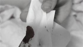 河南省商丘市夏邑縣上百名學生集體流鼻血。（圖／翻攝自網易，已做變色處理）