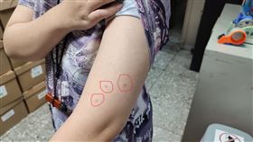 大多數蟎蟲生命期約3周內死亡。受害者呈三顆線狀或三角形排列的咬痕。（圖／新北市動保處提供）