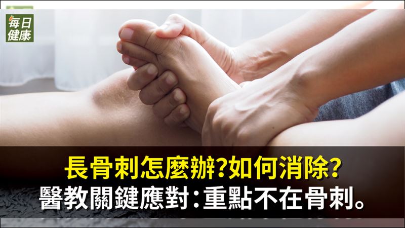 長骨刺不必太緊張！保養得宜可共存