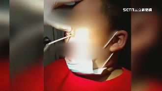 童快篩棉棒斷卡鼻腔嚇哭　醫曝小撇步