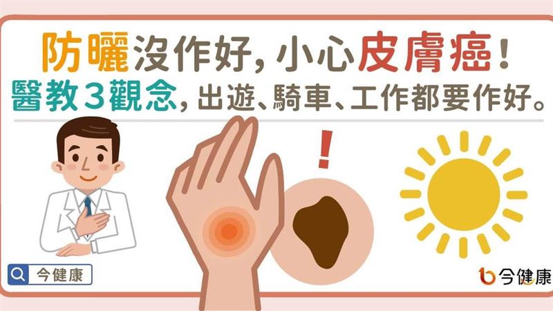 沒防曬好小心皮膚癌！醫教正確３觀念