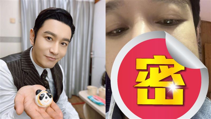 黃曉明慘「毀容」　臉腫成方形急求助
