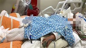 雲林6歲男童，確診，休克，高燒，猛爆性肝炎，洗肝搶回一命，蔡政憲(圖翻攝畫面)