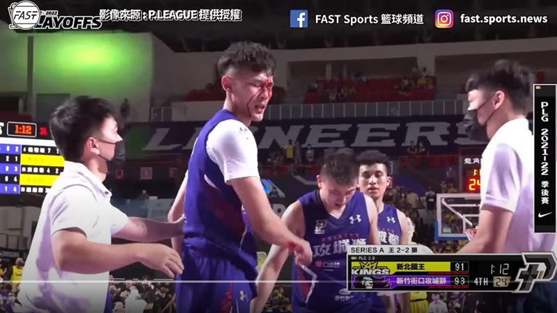 射手遭肘擊滿臉血　攻城獅GM曝傷情