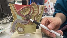 攝護腺癌,達文西,中國醫藥大學新竹附設醫院泌尿科主任陳冠亨,（圖／中醫大新竹附醫提供）