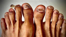 看了就痛！超馬鬥士陳彥博「腳指甲剝落照」　撼動2萬人，圖／翻攝自陳彥博臉書