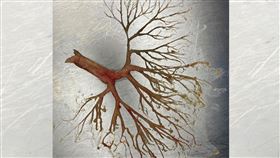 咳出一根人蔘。家庭醫學科醫師闕壯理授權提供