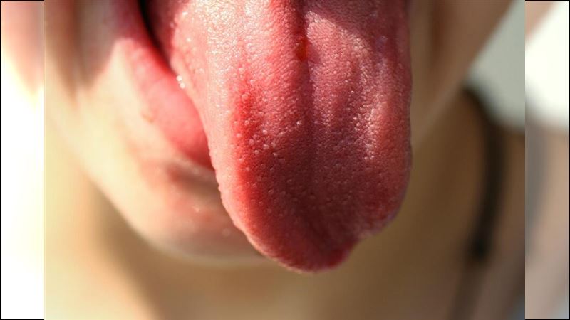 舌頭反映身體健康　小心舌苔厚重白膩