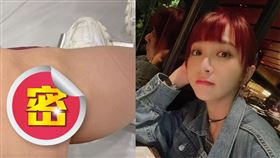 溫妮大腿撞傷出現大面積瘀傷，忍了數天看醫生才知裡面有瘀血。（圖／翻攝自yuen_nnnnnn IG）