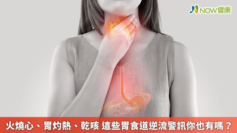 火燒心胃灼熱　恐是胃食道逆流警訊