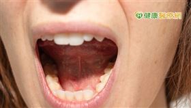 楊龍駿醫師分享，長期頭痛、背痛及腰痛患者，頻換醫院、不停找方式治療卻還是無顯著效果的話，即可考慮以撥筋或小針刀的方式，撥動深層肌肉，讓其沾粘或僵硬現象得以舒緩放鬆。