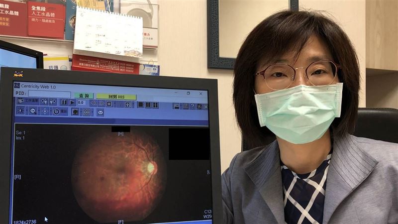 眼睛閃黑影以為飛蚊症　竟是「出血」