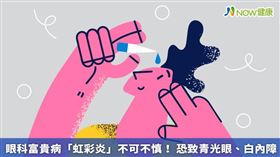 ▲虹彩炎初期在診斷時，因症狀較不明顯，故通常需要靠散瞳劑來分辨其病症實際為何。（圖／NOW健康製作；圖片來源／ingimage）