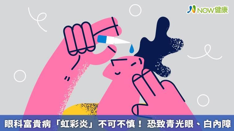 虹彩炎不可不慎　恐致青光眼、白內障