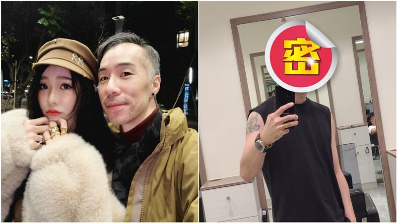 張兆志植髮8千根　半年後回春超驚人