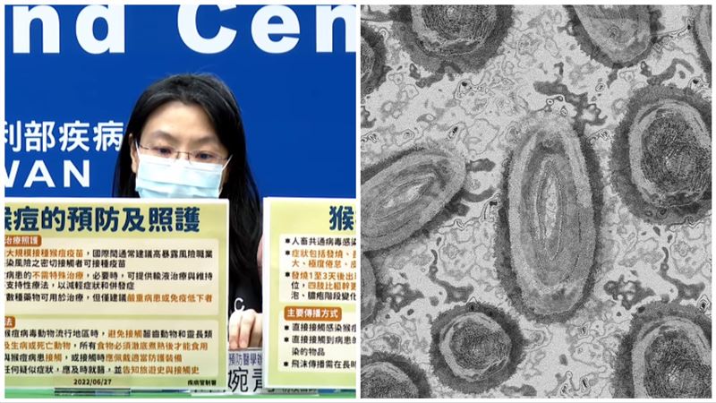 猴痘有3大傳播途徑　2類人須打疫苗