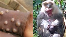 CDC提供＋記者鍾志鵬攝影萬芳醫院提供＋台南市衛生局提供、翻攝自美國CDC、WHO首頁