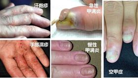 皮膚科 周宛儀醫師/真心皮膚科診所新授權提供