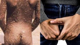 翻攝自美國CDC、pixabay