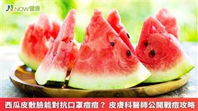 ▲民眾如有青春痘，千萬不能亂摳、擠破，也不可直接敷貼西瓜皮，以免造成皮膚過度刺激，變成接觸性皮膚炎。（圖／NOW健康製作；圖片來源／ingimage）
