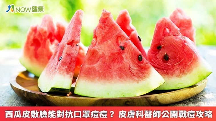 西瓜皮抑口罩痘？皮膚科醫揭戰痘攻略