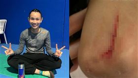 戴資穎曬傷勢照   笑稱皮肉傷「誰叫我腳跑比球慢」。ＩＧ