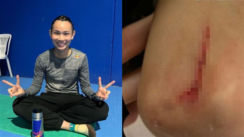 戴資穎受傷：別心疼我！誰叫腳比球慢
