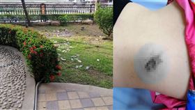 磁磚掉落,砸傷,男童,拉皮