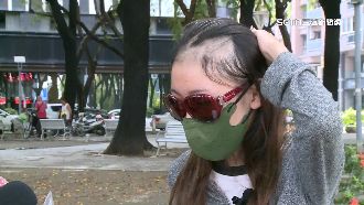 辣媽打莫德納　長髮掉光「頭半禿」