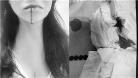 確診女睡夢中「大量咳血」急跑2醫院！蘇一峰曝最糟下場 蘇一峰臉書