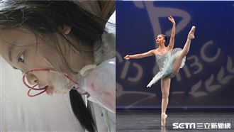 先天缺陷曾恨母　她靠實力進國際舞台