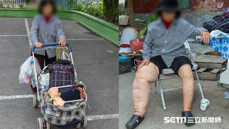 象腿嬤最慘50元度日　盼助挨餓弱勢