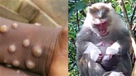 翻攝自美國CDC、記者鍾志鵬攝影、鍾曜任醫師提供、（圖／美聯社／達志影像）