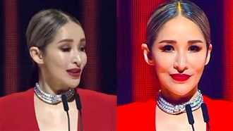 鷹鉤鼻超尖！蕭亞軒爆隆鼻　本人吐實