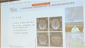 台大醫師表示，兒童重症更可能有神經系統的異常，恐出現腦血管病變導致缺血性中風。（圖／記者簡浩正攝影）