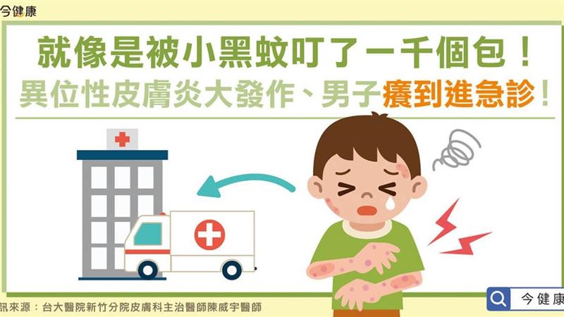 異位性皮膚炎大發作　癢到進急診？！