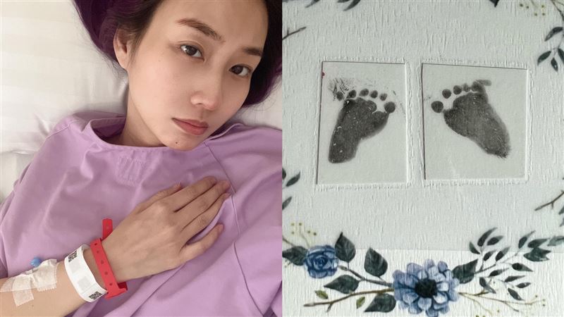 肚中胎兒罹罕病　女星忍痛引產現況曝