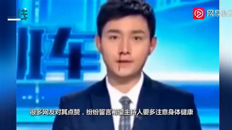 鼻血流到下巴！主播淡定報新聞超敬業