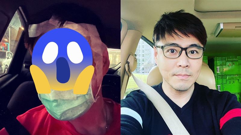 劉至翰突曬「臉包紗布染血照」嚇壞網