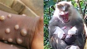 翻攝自美國CDC、pixabay、圖／美聯社／達志影像、翻攝自WHO網頁who.int、翻攝自WHO網頁who.int、記者鍾志鵬攝影