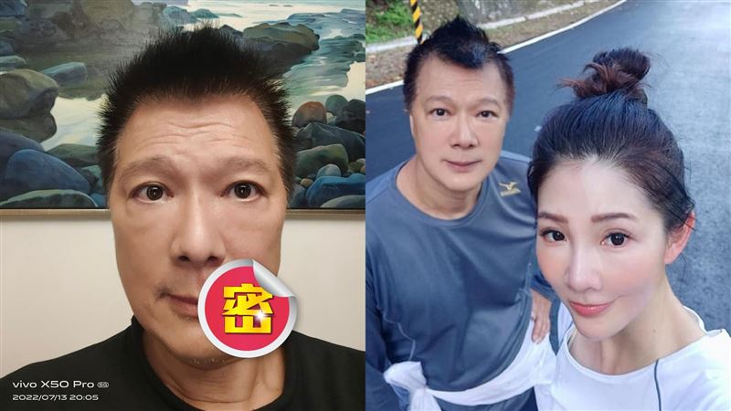 蔡詩萍臉部被病毒攻擊　妻1動作救命