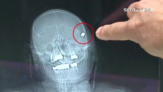 子彈未傷及賴敏男腦部　醫最擔憂這事