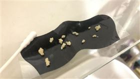 喉嚨卡卡，她用棉花棒擠出一排扁桃腺結石。（圖／翻攝自Dcard）