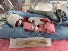 全球最小巴掌嬰在台中　出生僅鋁罐大（圖／翻攝畫面）
