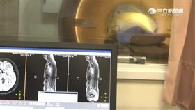 死亡時鐘調快20秒 驚!每年8千人死於肺癌