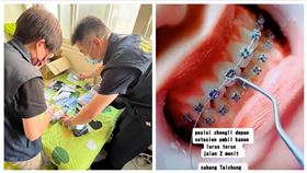 矯正牙齒,失聯移工,密醫,隆鼻,桃園專勤隊（圖／移民署桃園專勤隊提供）