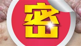 ▲陳小姐的蟹足腫背部隆起範圍已達20 *30 *20公分（圖／基隆長庚提供）