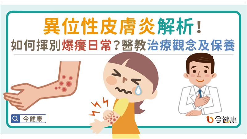 認識異位性皮膚炎　4大特徵告訴你！